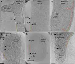 We did not find results for: Ultrastructure Of Exospore Formation In Streptomyces Revealed By Cryo Electron Tomography Biorxiv