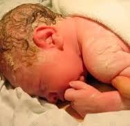 Vernix typically begins to accumulate in the last trimester of pregnancy and is thought to not only luckily, research has shown that delaying your baby's first bath and allowing that vernix to reside on. Benefits Of Vernix It S Amazing Stuff And Here S The Scientific Research To Prove It Birth Bliss