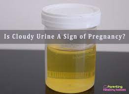 Is Cloudy Urine A Sign Of Pregnancy