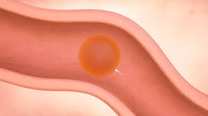 At 3 weeks pregnant, you've officially conceived and are in month 1 of your pregnancy — though it will be a few weeks until you can confirm the news with a pregnancy test. Your Guide To Being 3 Weeks Pregnant Enfamil Canada