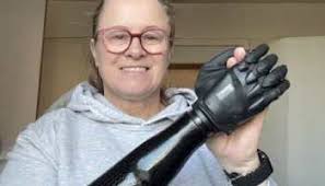 Case study: Personalised LEGO prosthetic fitted by specialist enablement  centre helps Tobi thrive