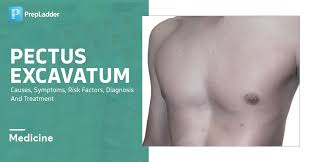 Image result for Pectus Excavatum