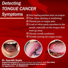 Image result for white cancer on tongue)
