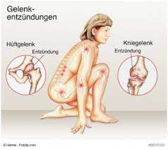 Check spelling or type a new query. Schmerztherape Munchen Akupunktur Kniearthrose Erfolgreich Behandeln