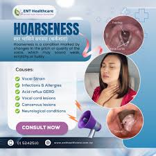 Image result for Hoarseness