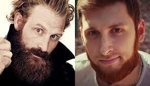 images?q=tbn:ANd9GcQ0VtY8RskCcl4QElLoMMK