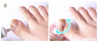 He bandaged each toe, and i went home. Toenail Cuticle Care Nailbees