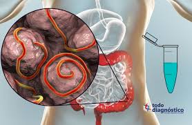 Las enfermedades infecciosas están causadas por microorganismos, tales como bacterias, virus, hongos y parásitos causan. Diagnostico Sindromico De Las Infecciones Parasitarias Todo Diagnostico