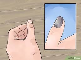 Banyak percaya kalau mimpi bisa menentukan takdir. 3 Cara Untuk Menangani Jari Yang Terpukul Palu Wikihow