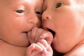 Monochorionic twins deviates at 28 weeks. Twins And Multiple Babies