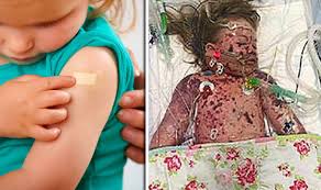 Here are some questions that we are regularly asked. Meningitis B Warning Has Your Child Had The Vaccine Express Co Uk