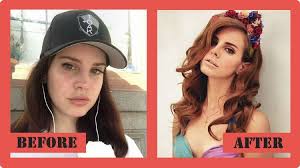 Lana del rey to plastic surgery. Lana Del Rey Plastic Surgery Before And After Lana Del Rey Plastic Surgery Lanadelrey Celebritypost Plastic Surgery Celebrity Plastic Surgery Lana Del Rey