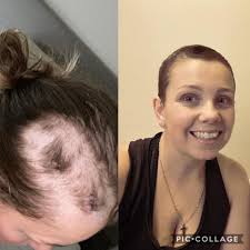 FocusOnOvercoming. "When we think about giving up, we remember the reason  why we started." #JúlioOvercoming.♿️