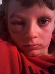 American Legion Baseball: Getting back in the game