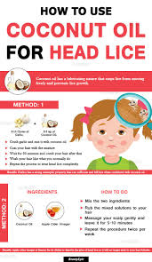 How To Get Rid Of Lice Fast With Coconut Oil Coconut Oil For Acne Coconut Oil Hair Treatment Coconut Oil For Teeth