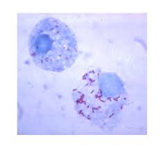 Image result for Rickettsiae