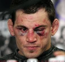 UFC 129 Fight Card: Jose Aldo and 55 Fighters Who Can Finish