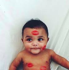 Schlimme Folgen Deshalb Solltest Du Niemanden Erlauben Ihr Kind Auf Die Lippe Zu Kussen Seite 5 Von 5 Mit Bildern Kinder Babybilder Babys Bilder