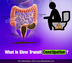 Slow Transit Constipation Symptoms Diagnosis Treatments