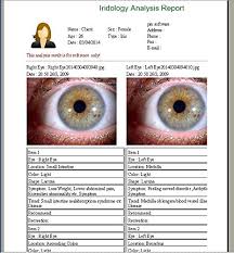 How To Read Eyes Iridology By Color Iridology Software