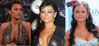 Since then, he's worn a prosthetic nose to hide the huge. Jwoww Plastic Surgery Before And After Pictures 2021