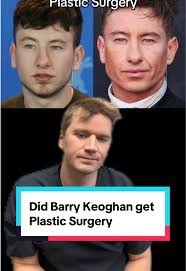 Opiniones sobre la cirugía plástica de Barry Keoghan
