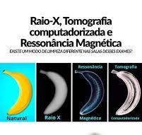 Você conhecia a diferença entre os exames de imagem: Raio-X(RX), tomagrafia  computadorizada(TC) e ressonância magnética(RM)? , Esta imagem usa uma  banana de forma humorística e eficaz para ilustrar ...