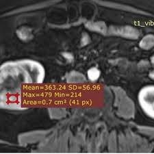 Abdullah Armagan's research works