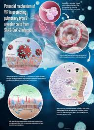 Relief Therapeutics And Neurorx Announce Final Manufacturing Validation Of Rlf 100 For Phase 2b 3 Clinical Trial In Patients With Covid 19 Associated Acute Respiratory Distress Syndrome
