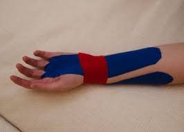 Handgelenk Tapen Mit Kinesiotape Bei Schmerzen