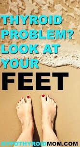 10 Signs Your Feet Are Warning You About A Thyroid Problem Hypothyroid Mom Thyroid Problems Thyroid Thyroid Health