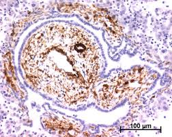 They are spindle shaped and have no striations. Alpha Smooth Muscle Actin Asma Expression In A Case Of Autosomal Download Scientific Diagram