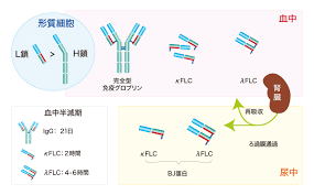 Maybe you would like to learn more about one of these? å¤šç™ºæ€§éª¨é«„è…«ã‚'ã¯ã˜ã‚ã¨ã™ã‚‹å˜ã‚¯ãƒ­ãƒ¼ãƒ³æ€§ã‚¬ãƒ³ãƒžã‚°ãƒ­ãƒ–ãƒªãƒ³è¡€ç—‡ã®è¨ºæ–­è£œåŠ©ã« Mbl è‡¨åºŠæ¤œæŸ»è–¬
