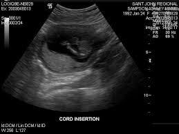 Check spelling or type a new query. Pico Song Club Posts Facebook