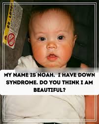 Noah's beauty captured in one image