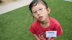 Moebius syndrome, food may accumulate behind the teeth and cause decay. Moebius Syndrome Disorder Present In Birth Congenital