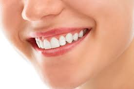 A gummy smile can be caused by an abnormal tooth eruption, jaw development problem, an improper bite, muscular issues, or a hyperactive upper lip orthodontics such as braces and invisalign can help correct the jaw problems and bite issues which can help make your gums appear smaller when smiling. Tips For Fixing A Gummy Smile