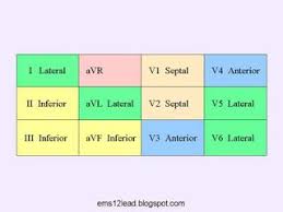 Here Are Some Charts To Help You Identify And Localize Acute