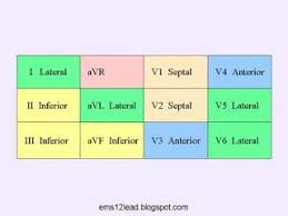 here are some charts to help you identify and localize acute