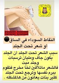 Pin By هيام On اهتمام وعنايه بكل شيء Beauty Skin Care Routine Glowing Skin Mask Skin Mask