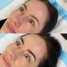 Frame Brow Clinic (@framebrowclinic) · Instagram 照片和视频