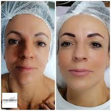 Pin de FÁTIMA CARRASCO en II NUESTROS ANTES Y DESPUES II