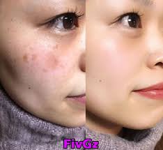 スキンケア スキンケア