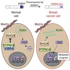 This year, an estimated 281,550 women in it is estimated that 44,130 deaths (43,600 women and 530 men) from breast cancer will occur this year. Kibra Wwc1 Is A Metastasis Suppressor Gene Affected By Chromosome 5q Loss In Triple Negative Breast Cancer Sciencedirect