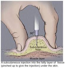 Image result for Subcutaneous Injection
