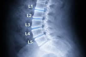 Image result for Low Back Imaging