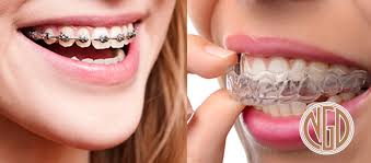 How to remove your braces no pain at home. 9 Hacks For Using Invisalign New Generation Dentistry Mission Viejo
