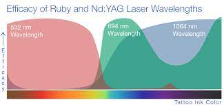 Cost can depend on the size of your tattoo, how colorful it is and where you live. How Tattoo Removal Works Training From New Look Laser College