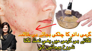 Saf pani say nahana in garmi dano say bachnay ka aik buhut azmoda tariqa hai. Garmi Dano Ka Fori Khatma Get Rid Of Prickly Heat Rash Instantly In Urdu Hindi By Dr Bilquis The Cook Book