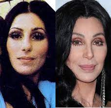 Gone are the days when you could spot somebody who had plastic surgery procedures with ease. When People Say Cher Is Unrecognizable From All The Plastic Surgery R Cher
